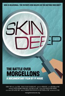 دانلود مستند Skin Deep: The Battle Over Morgellons 2019104233-1786531891